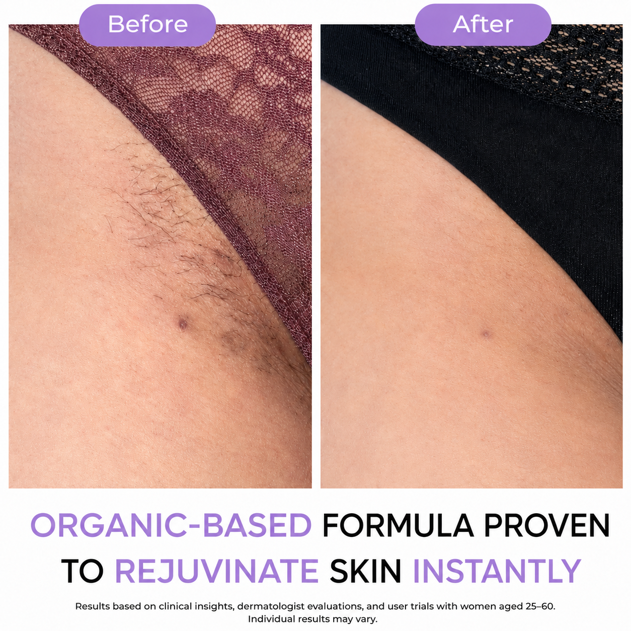 Hair Removal Spray