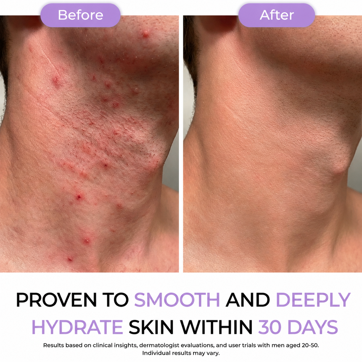 Hair Removal Spray